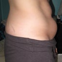 One month before procedure
