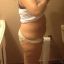 This photo taken 6 full days after surgery.