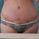 PO Week 5