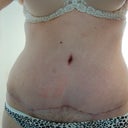 PO Week 5