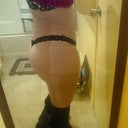 3 weeks post opp