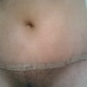 Close up. Sorry. :) The puckering on my left side is almost gone, just as my PS said to would. The incision is still covered under the steristrip. It is long, but low and I love it. Bonus was that my PS removed some of the hair-bearing skin! Ha! Complimentary hair removal! :)
