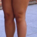 Thighs B4 2008 lipo