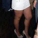 Thighs after 2008 lipo
