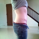 16 weeks post op