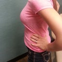 with the 457 sizers at my pre-op