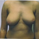 Before any surgery