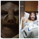 In the hospital after surgery. Felt like hell and looked like a scary pig.