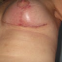 Week 5  left side