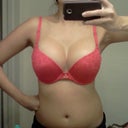 post-op day 26