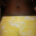 3 weeks post op this is how they look now my scar and bellly button.