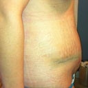 Swollen 19 days in the morning