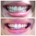 Before/Tray 8