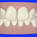 ClinCheck - Before View