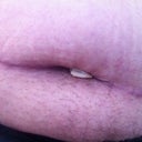 wound looking up at swelling and pouch