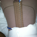 2hrs after surgery