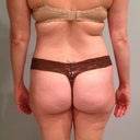 back view - ugh can't wait until this is done