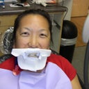 before zoom whitening - the shielding