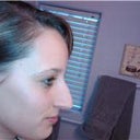 Nose BEFORE