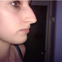 right angle BEFORE