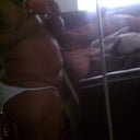 Pre-op Side