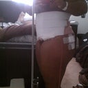 Day 1 post-op side