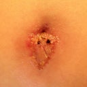 My "belly button"  :/