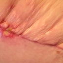 Upper left- bump. Lower left- open wound. Plus "pleated" skin folds. :/
