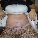3 day picure..swelling by the minute! another painful day