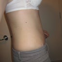 2 weeks post op, side after a shower