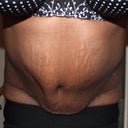 14 weeks not breathing, slightly bent forward.