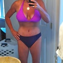 12 days post op!
