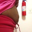 Pre-Op (Side View)