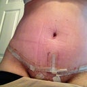 11dpo close up
