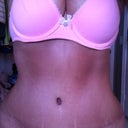 13 wks post