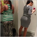 Before/after no more back fat/love handles..I love my new curves and the way I look in a tight dress! 3 weeks before and 2 weeks after surgery