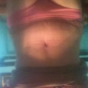 Still puffy six weeks out. I bought a stage 2 binder and it's helping.