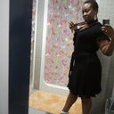 This was taken about a week ago....no compression garment.
