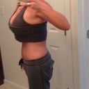 4 months post op