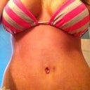Post op day 4