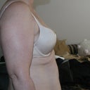 Pre lipo arms