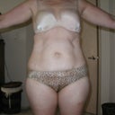 Pre lipo