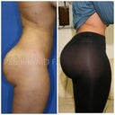 Curvy and full no shelf