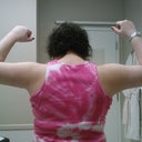 The view from the back the day stitches came out, still VERY swollen