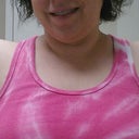 you can see a few of the stitches on my right side at the underarm