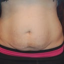See that little mole right in the middle of my upper abdomen?!? It is now just above my belly button LOL!