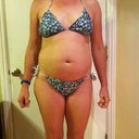 Here I am front view bikini just before surgery.  'I've got the whooooole world... in my belly!  I've got the whoooooole world.... in my belly!"