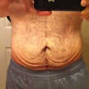 My "before" pic. Aug 2011.