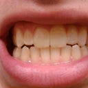 After Image