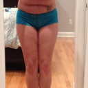 Night before surgery front leaning over
